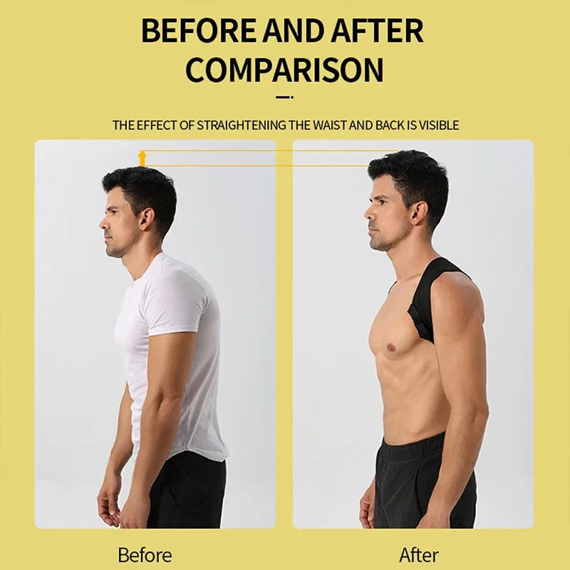 Adjustable Posture Corrector